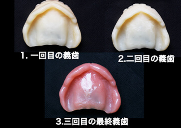 入れ歯をお試しできる！